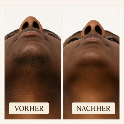 Lunvé Soft Touch | Gesichts-Enthaarungscreme für empfindliche Haut